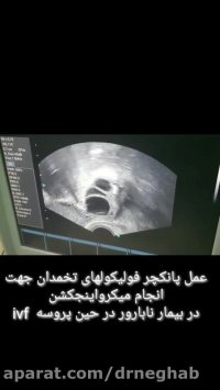 فیلم واقعی از روند IVF